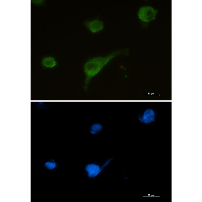 Syntrophin alpha 1 Rabbit mAb ABZ2176