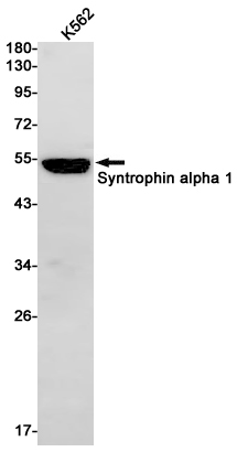 Syntrophin alpha 1 Rabbit mAb ABZ2176