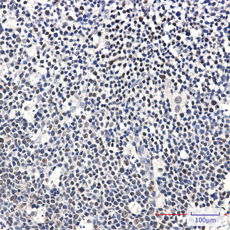 Ikaros Rabbit mAb ABZ2177