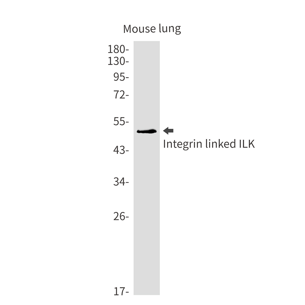 ILK Rabbit mAb ABZ2178