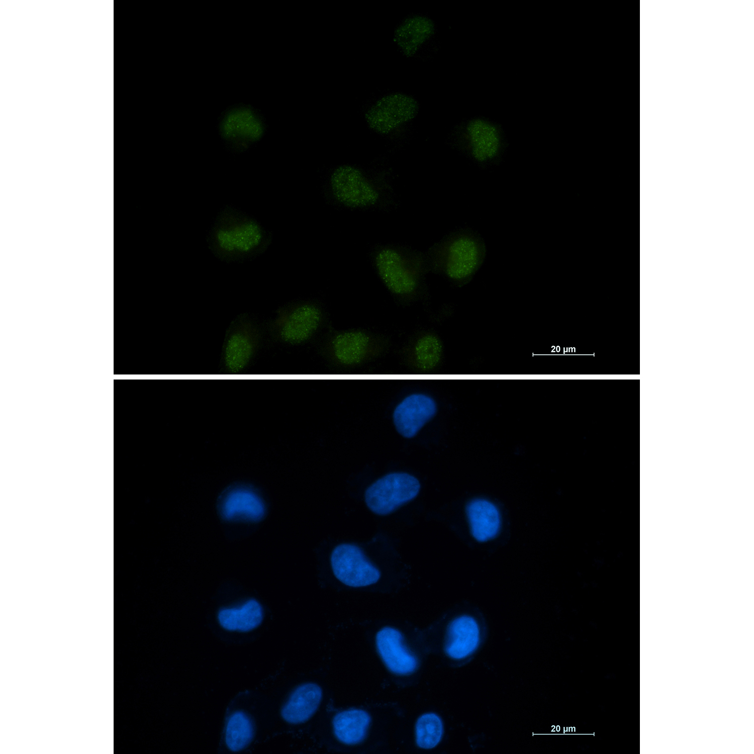 CTBP1 Rabbit mAb ABZ2179