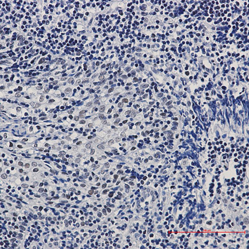 CTBP1 Rabbit mAb ABZ2179