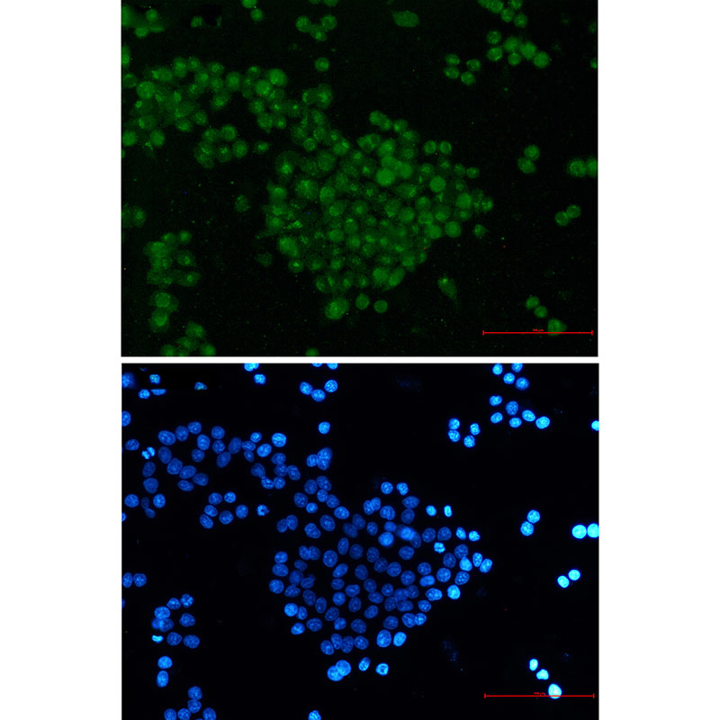 SKP2 Rabbit mAb ABZ2182