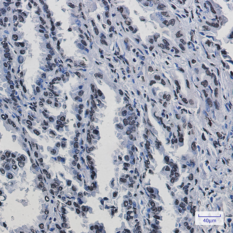 KAP1 Rabbit mAb ABZ2183