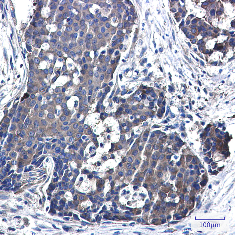 NME3 Rabbit mAb ABZ2184
