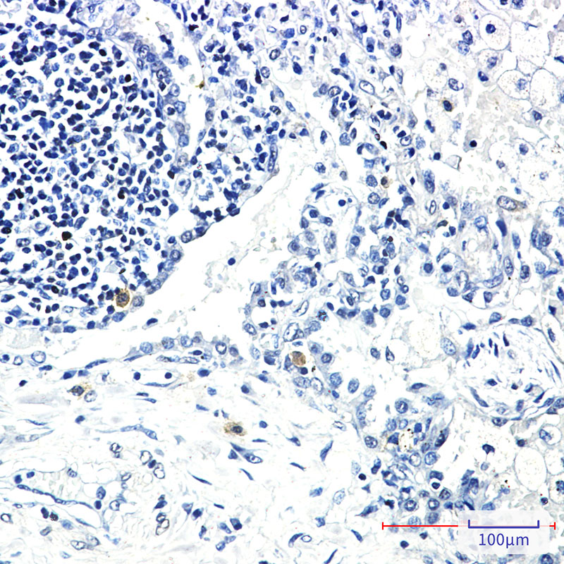 STK3/MST-2 Rabbit mAb ABZ2185