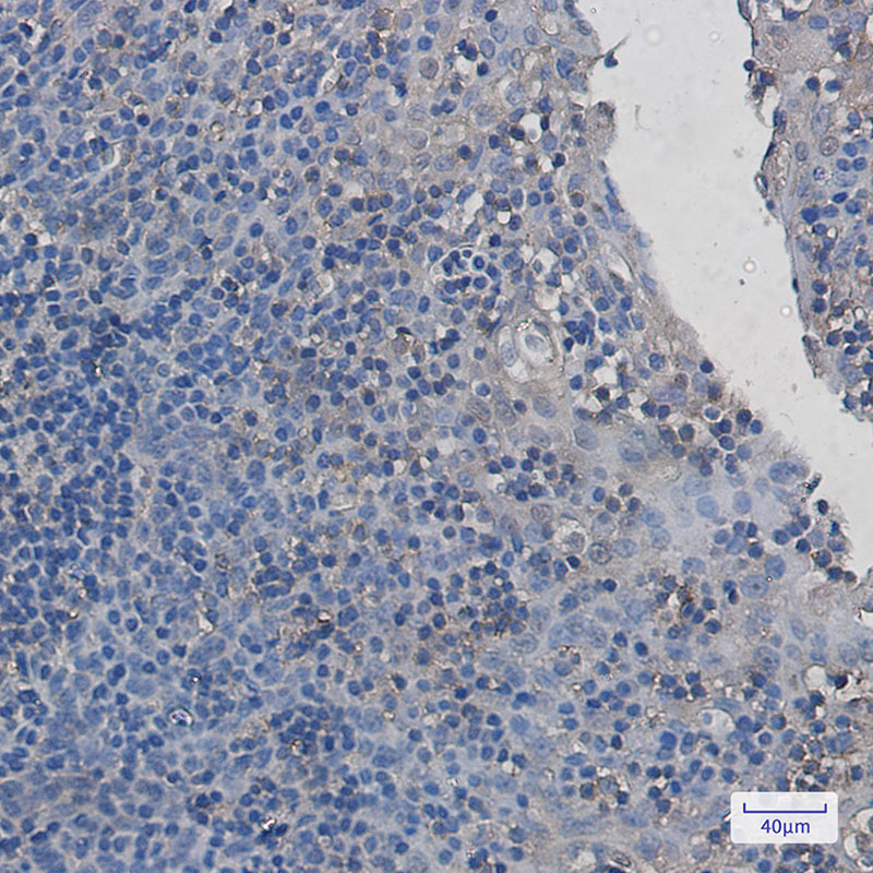 PAK2 Rabbit mAb ABZ2186