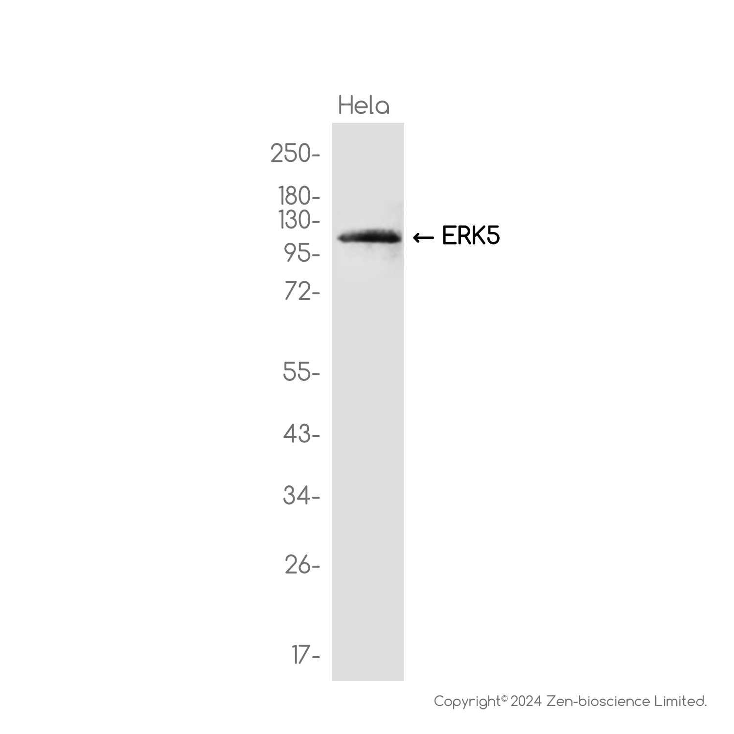ERK5 Rabbit mAb ABZ2187