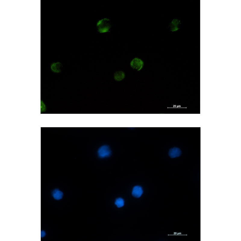 PAK1 Rabbit mAb ABZ2190