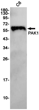 PAK1 Rabbit mAb ABZ2190