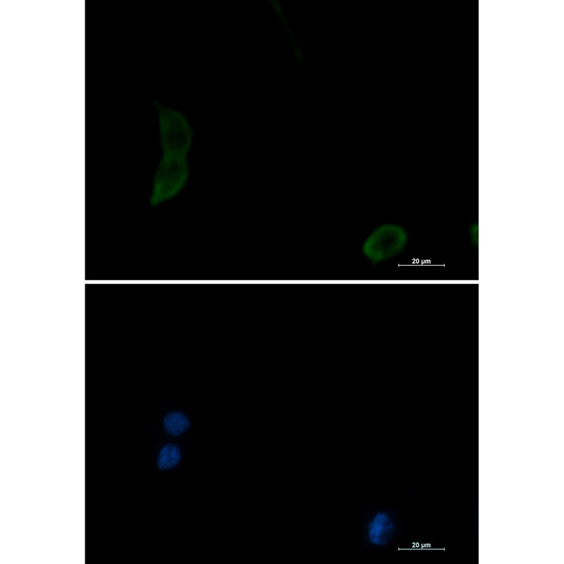 PAK1 Rabbit mAb ABZ2191