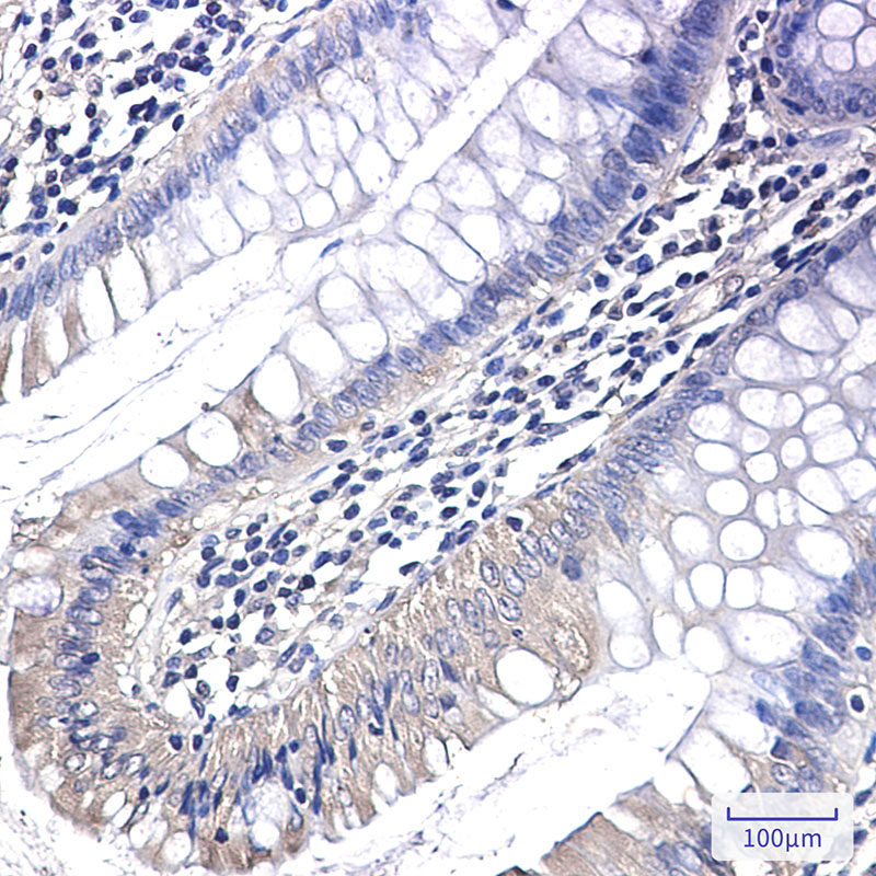 PAK1 Rabbit mAb ABZ2191
