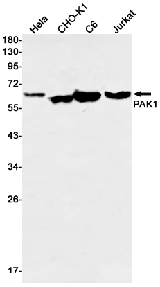 PAK1 Rabbit mAb ABZ2191