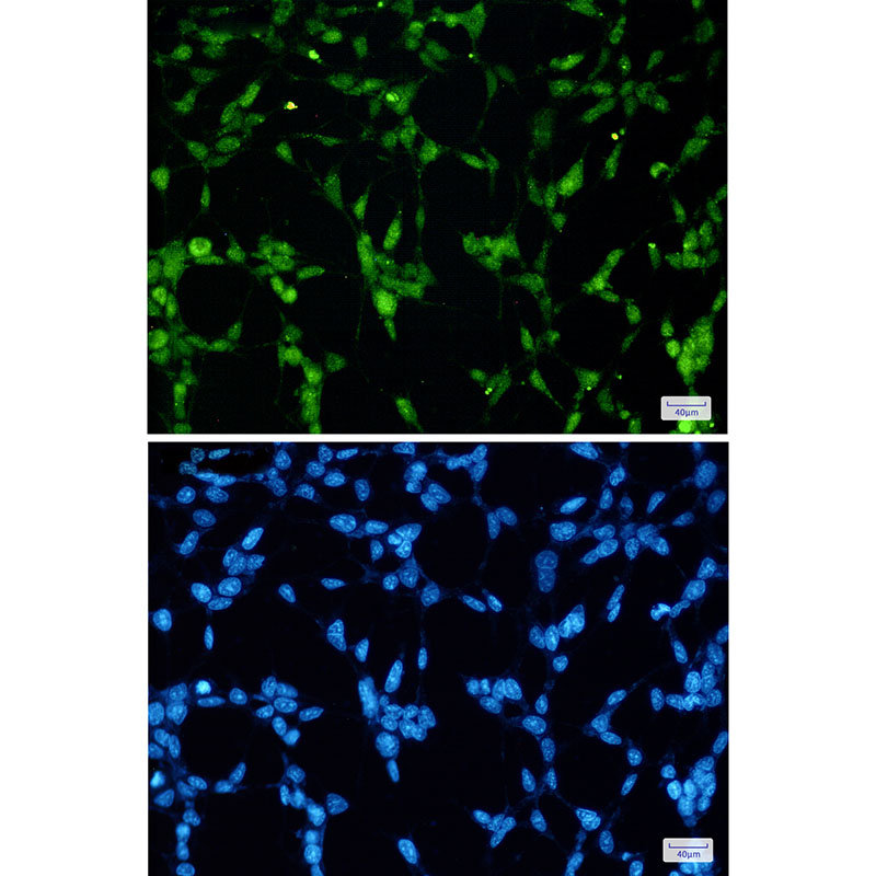 TDP43 Rabbit mAb ABZ2192