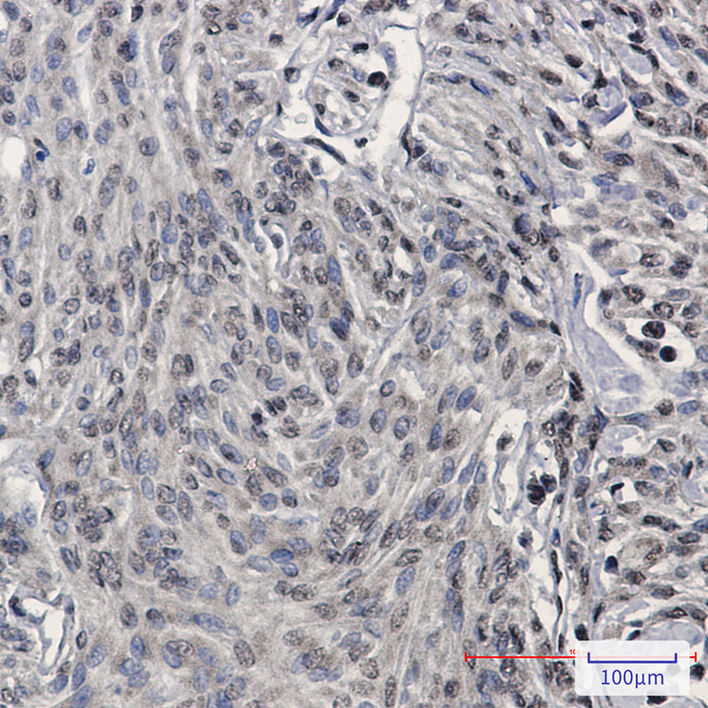 TDP43 Rabbit mAb ABZ2192