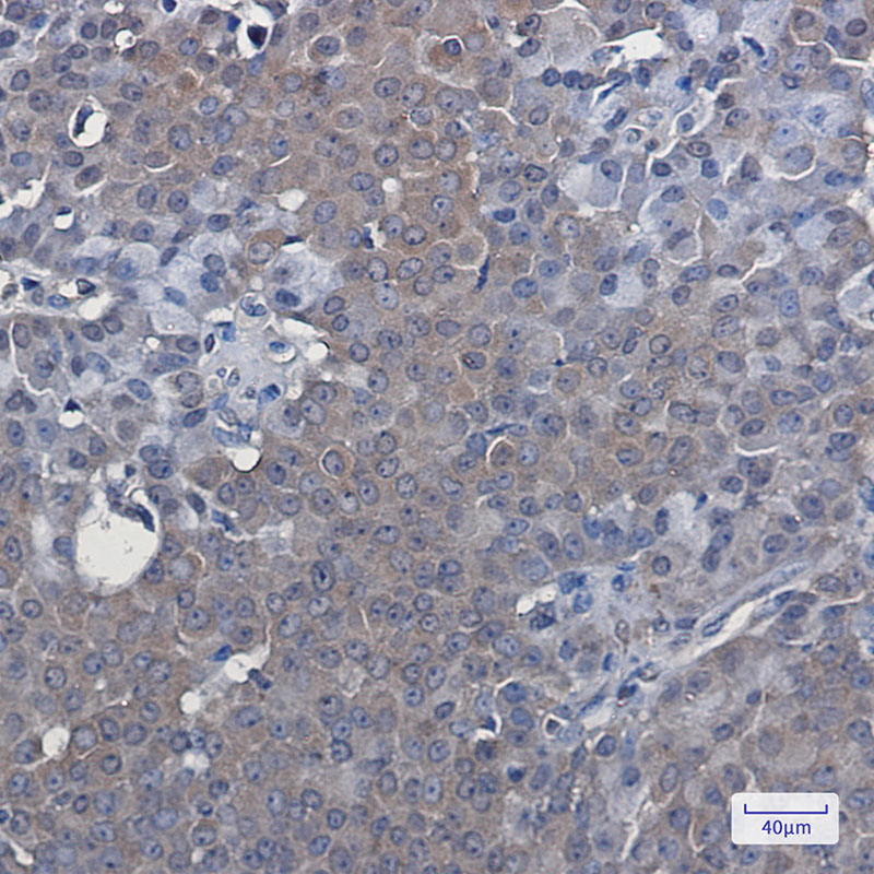LXR alpha Rabbit mAb ABZ2193