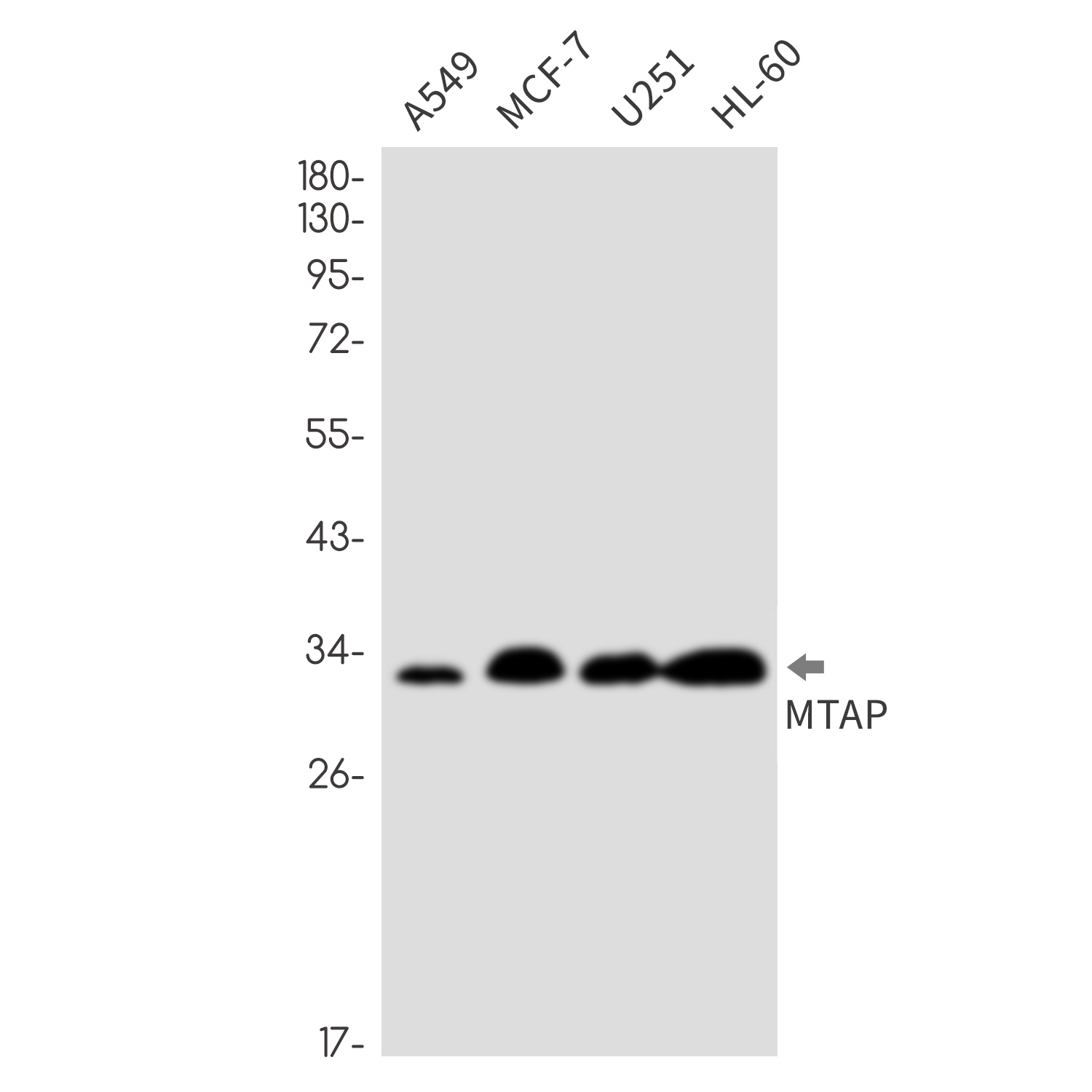 MTAP Rabbit mAb ABZ2194