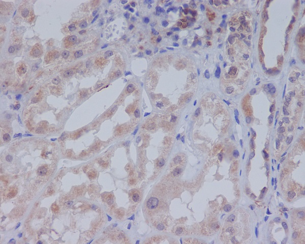 Acetyl Coenzyme A Carboxylase Rabbit mAb ABZ2197