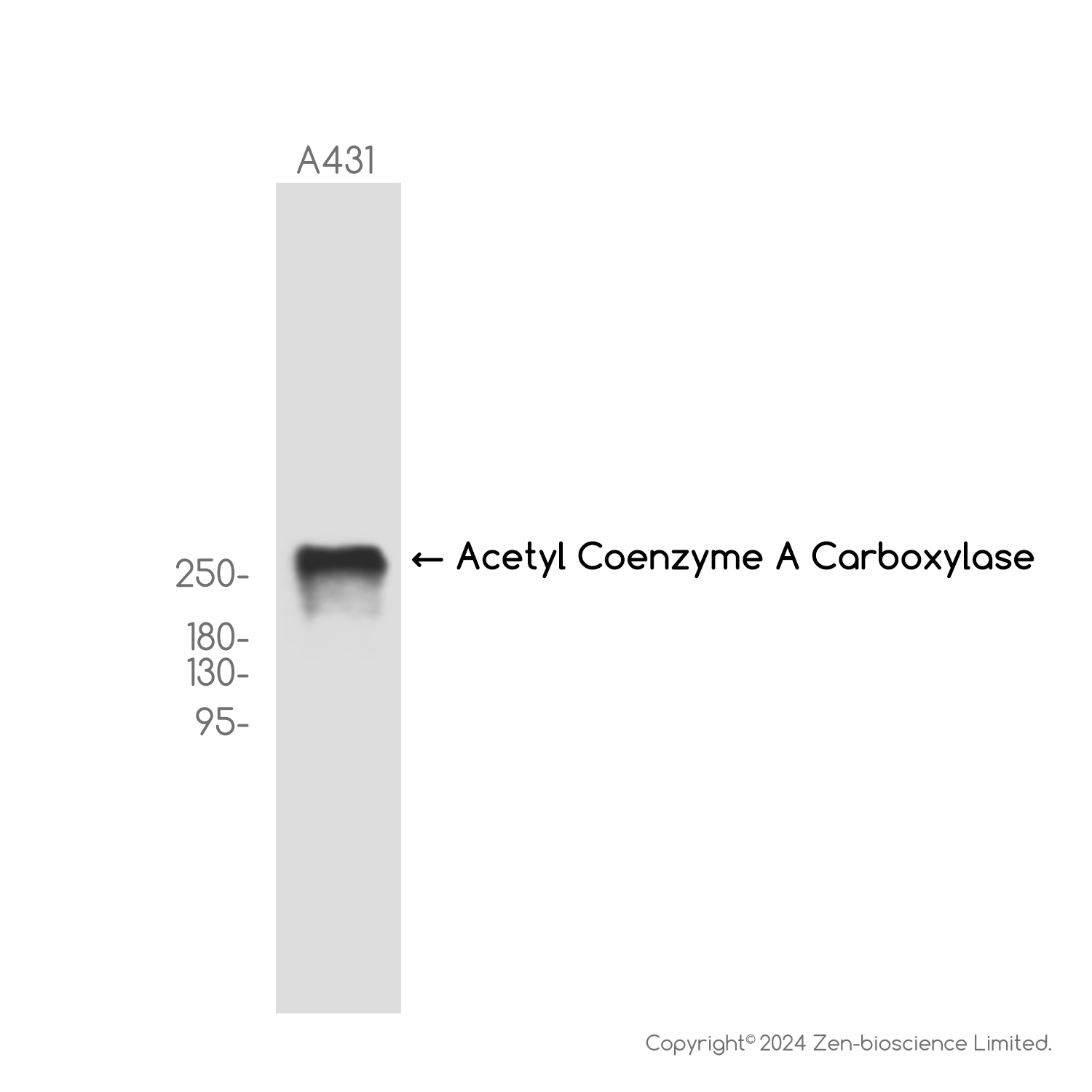 Acetyl Coenzyme A Carboxylase Rabbit mAb ABZ2197