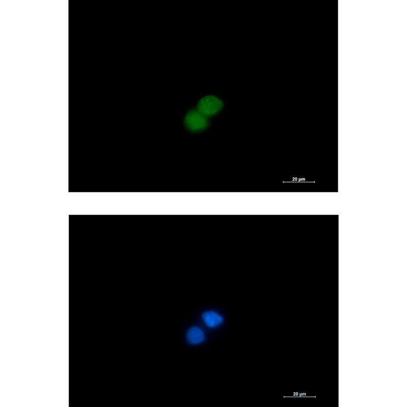 MSP/MST1 Rabbit mAb ABZ2198