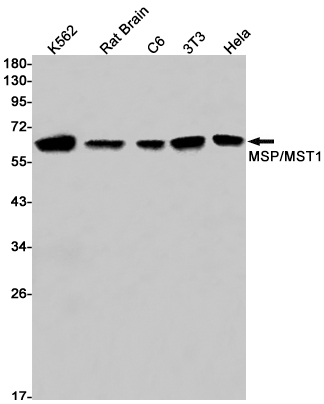 MSP/MST1 Rabbit mAb ABZ2198