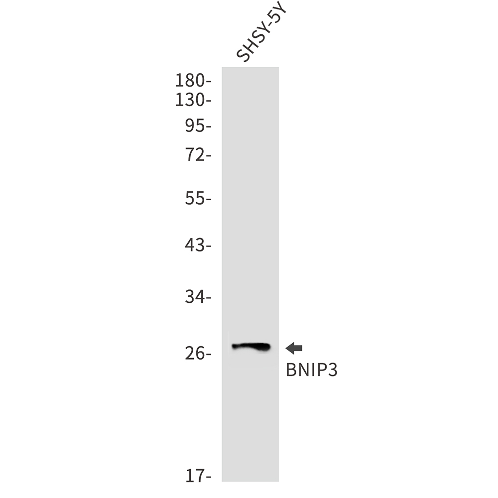BNIP3 Rabbit mAb ABZ2199