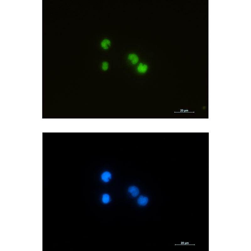 ILF3 Rabbit mAb ABZ2204