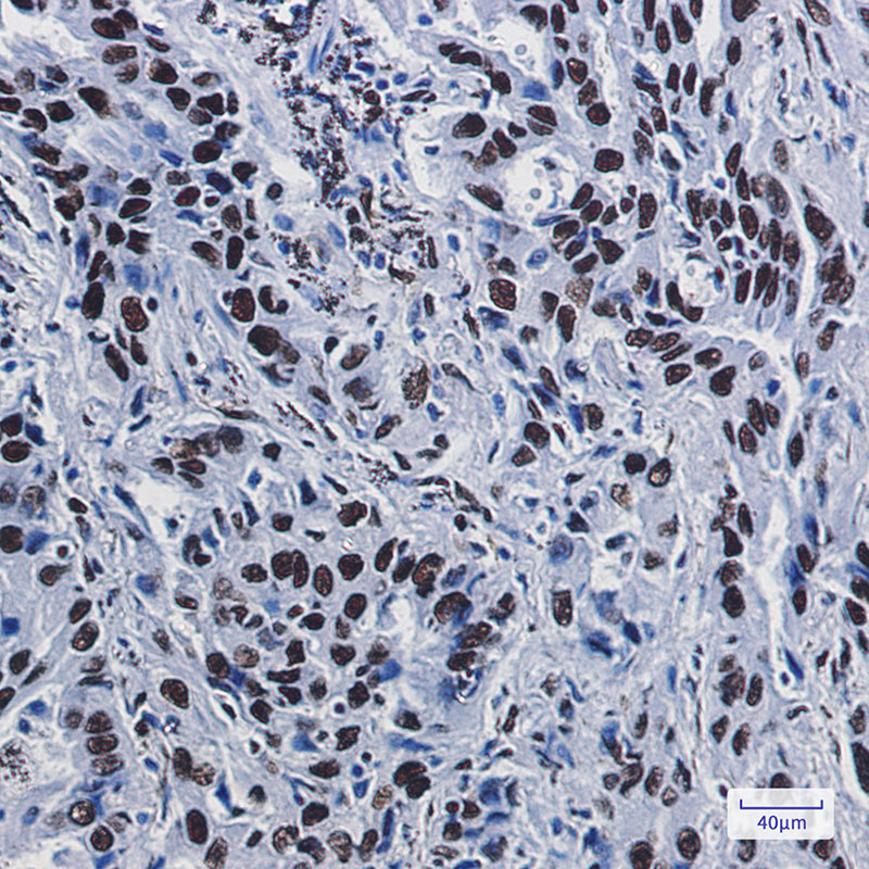 ILF3 Rabbit mAb ABZ2204
