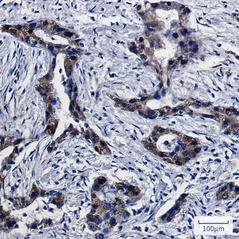 DPD Rabbit mAb ABZ2205