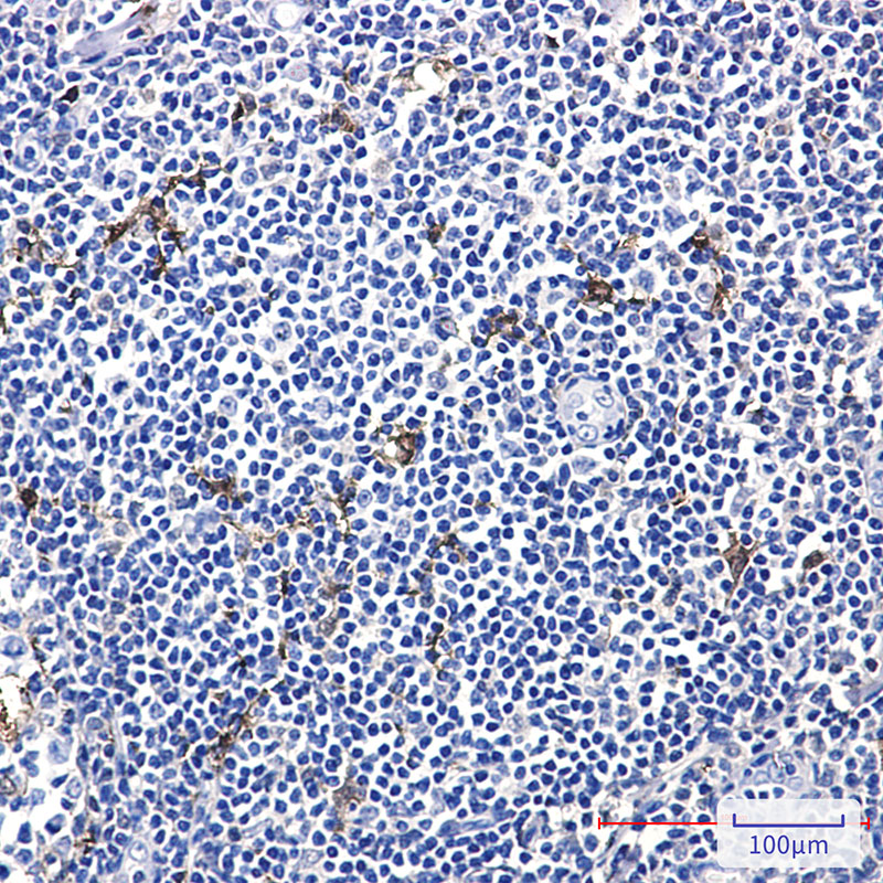 MERTK Rabbit mAb ABZ2207