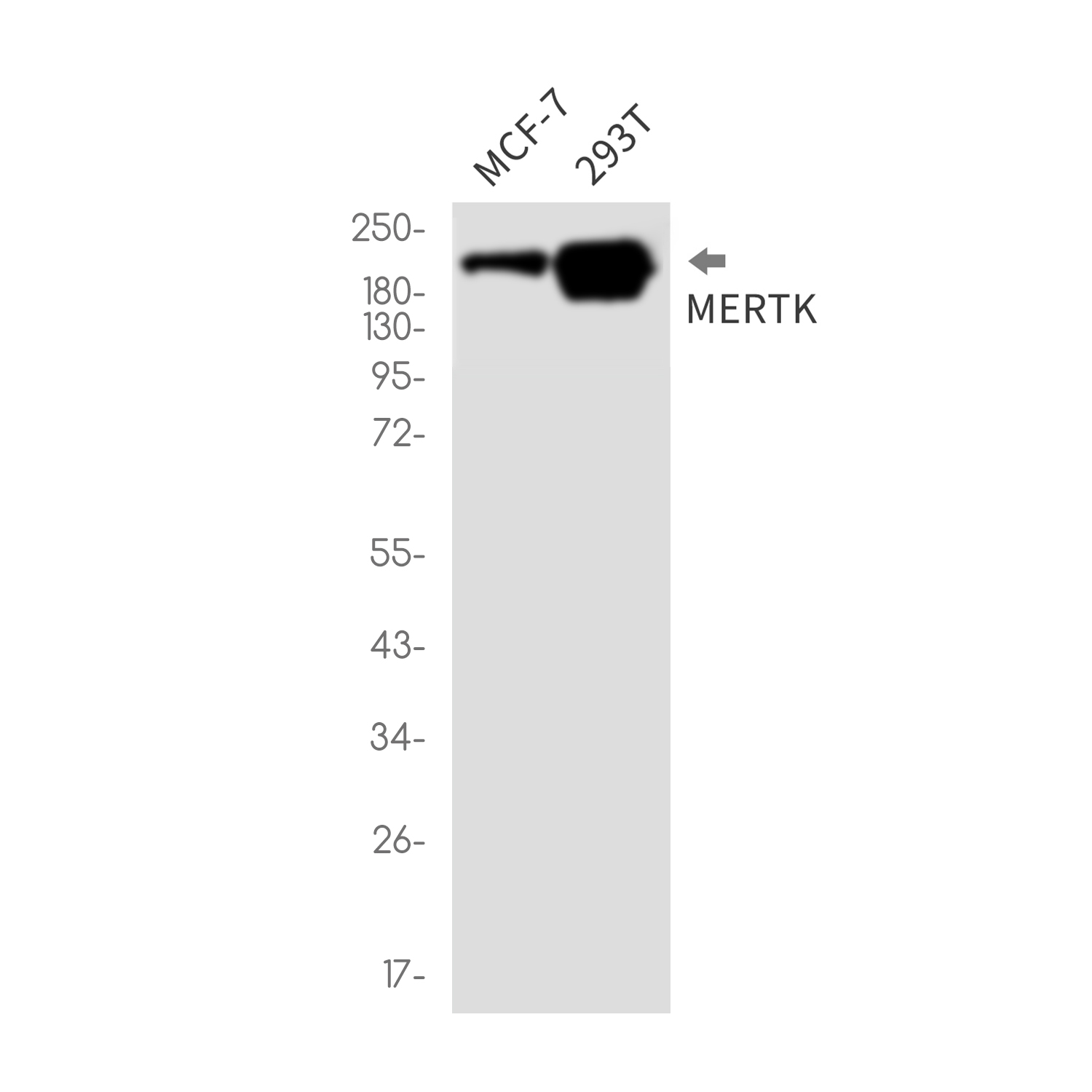 MERTK Rabbit mAb ABZ2207