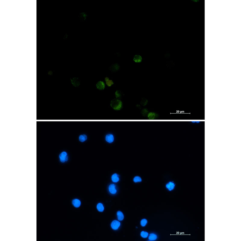 GRSF1 Rabbit mAb ABZ2208