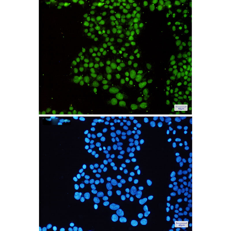 SNF5/SMARCB1 Rabbit mAb ABZ2210