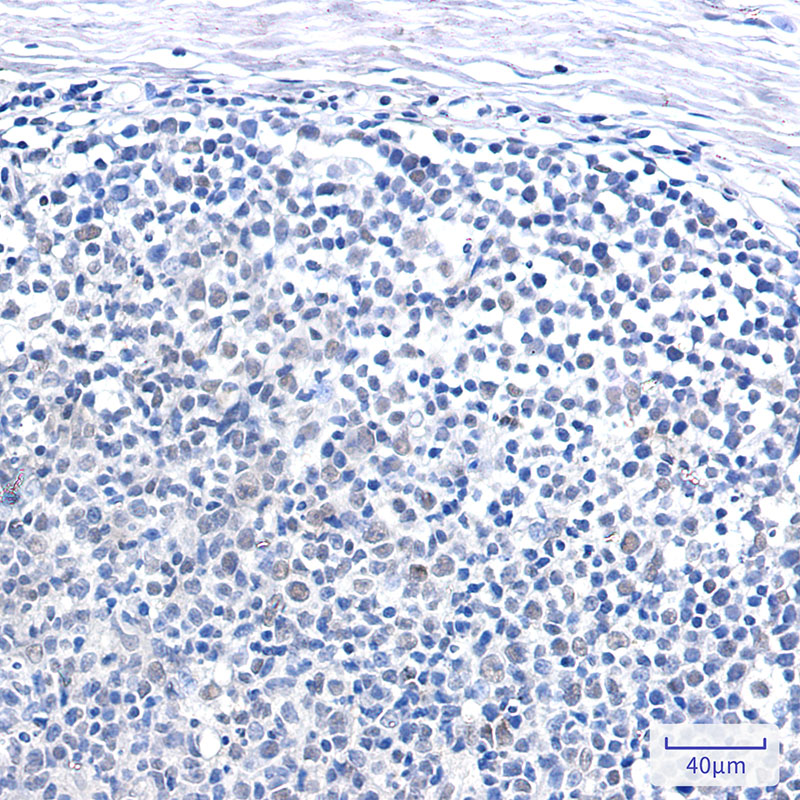 SNF5/SMARCB1 Rabbit mAb ABZ2210
