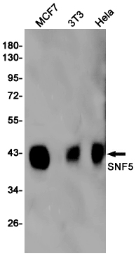 SNF5/SMARCB1 Rabbit mAb ABZ2210