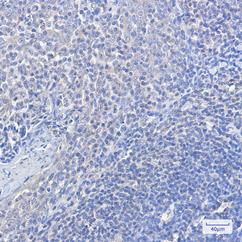 FOXO1 Rabbit mAb ABZ2211