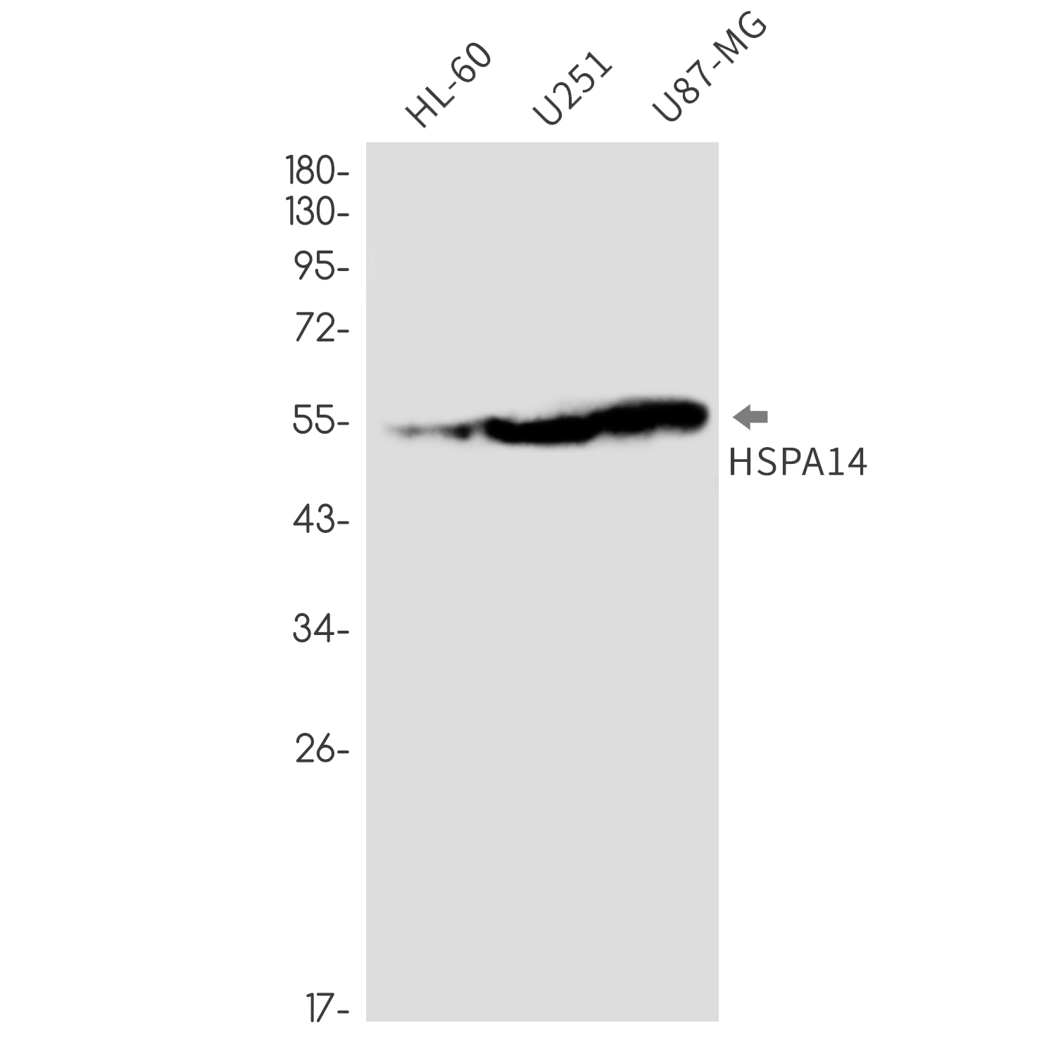 HspA14 Rabbit mAb ABZ2212