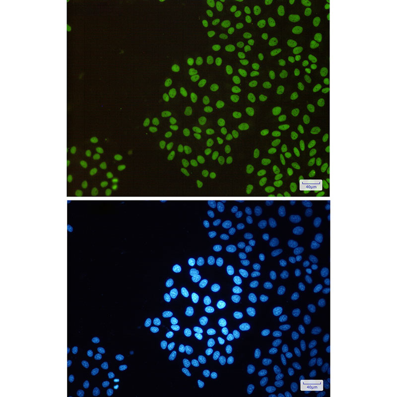 RBBP4 Rabbit mAb ABZ2213