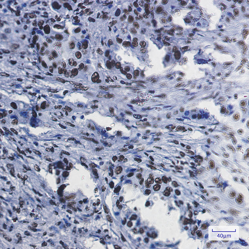 RBBP4 Rabbit mAb ABZ2213