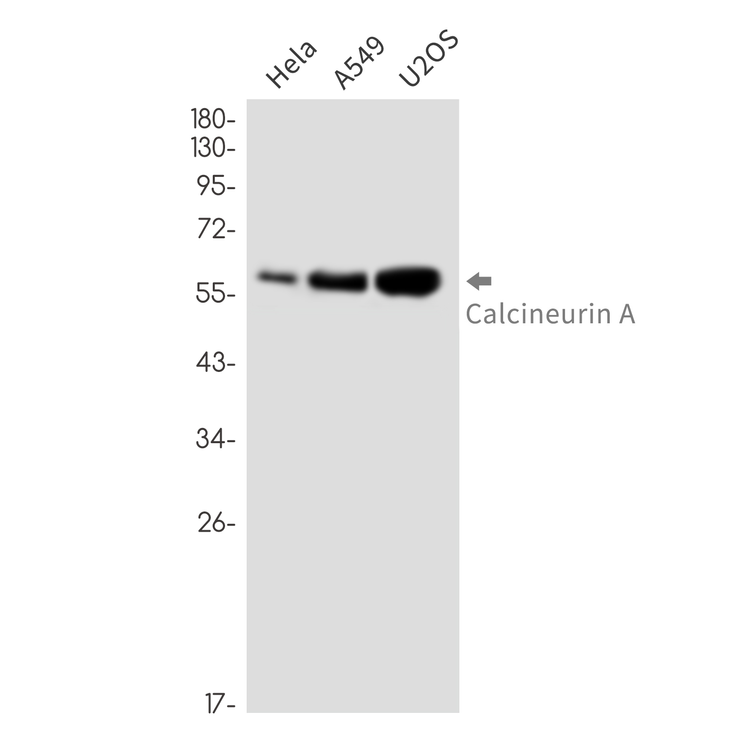 Calcineurin A Rabbit mAb ABZ2216