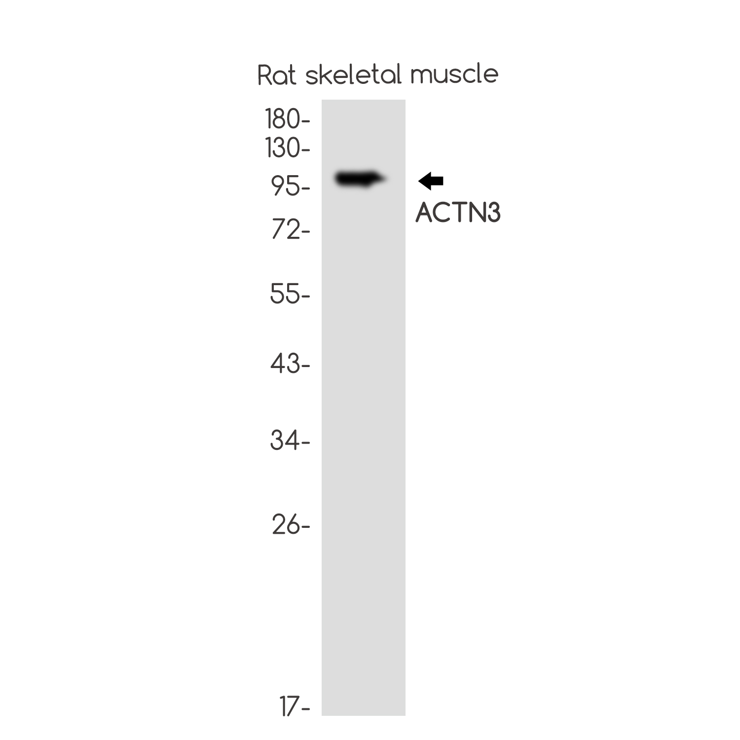 ACTN3 Rabbit mAb ABZ2217