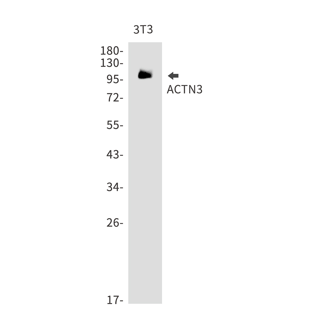 ACTN3 Rabbit mAb ABZ2217