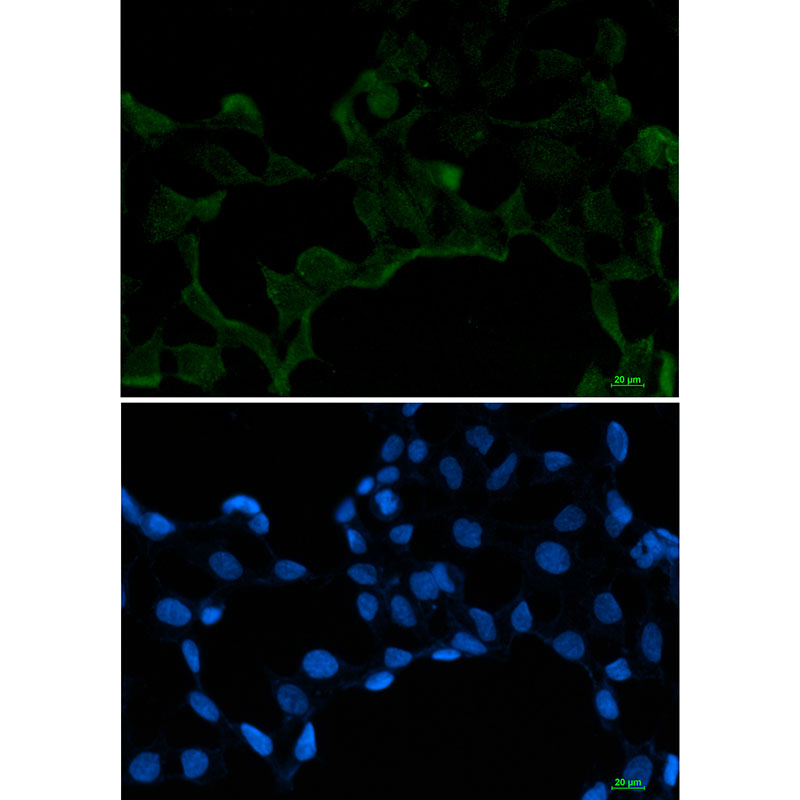 SF2 Rabbit mAb ABZ2218