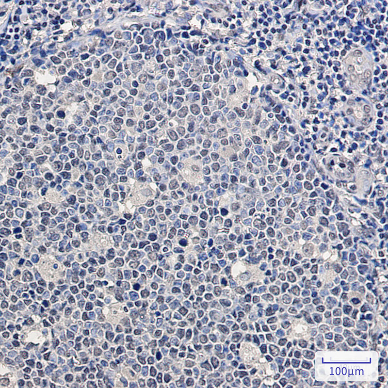 SF2 Rabbit mAb ABZ2218
