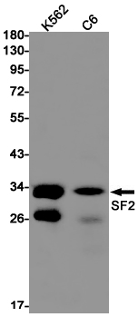 SF2 Rabbit mAb ABZ2218