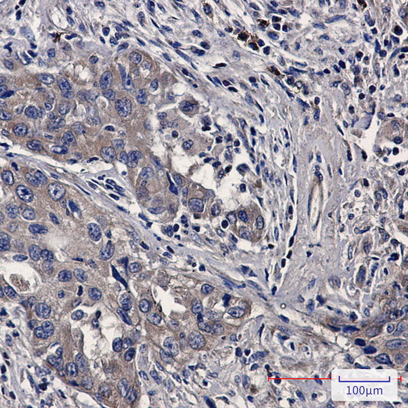 Bax Rabbit mAb ABZ2222