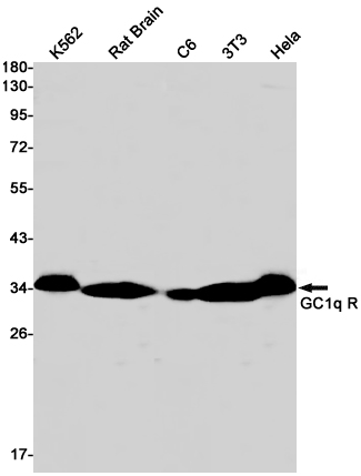 GC1q R Rabbit mAb ABZ2224
