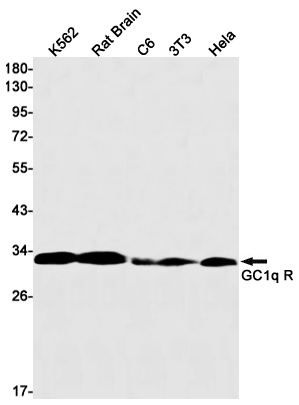 GC1q R Rabbit mAb ABZ2225