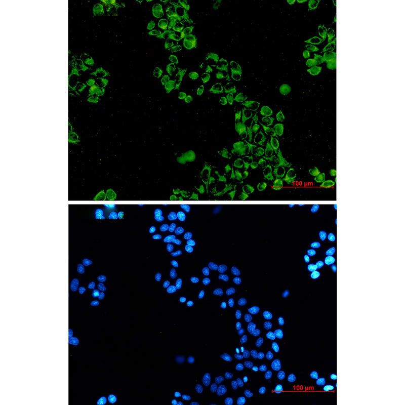 GC1q R Rabbit mAb ABZ2226