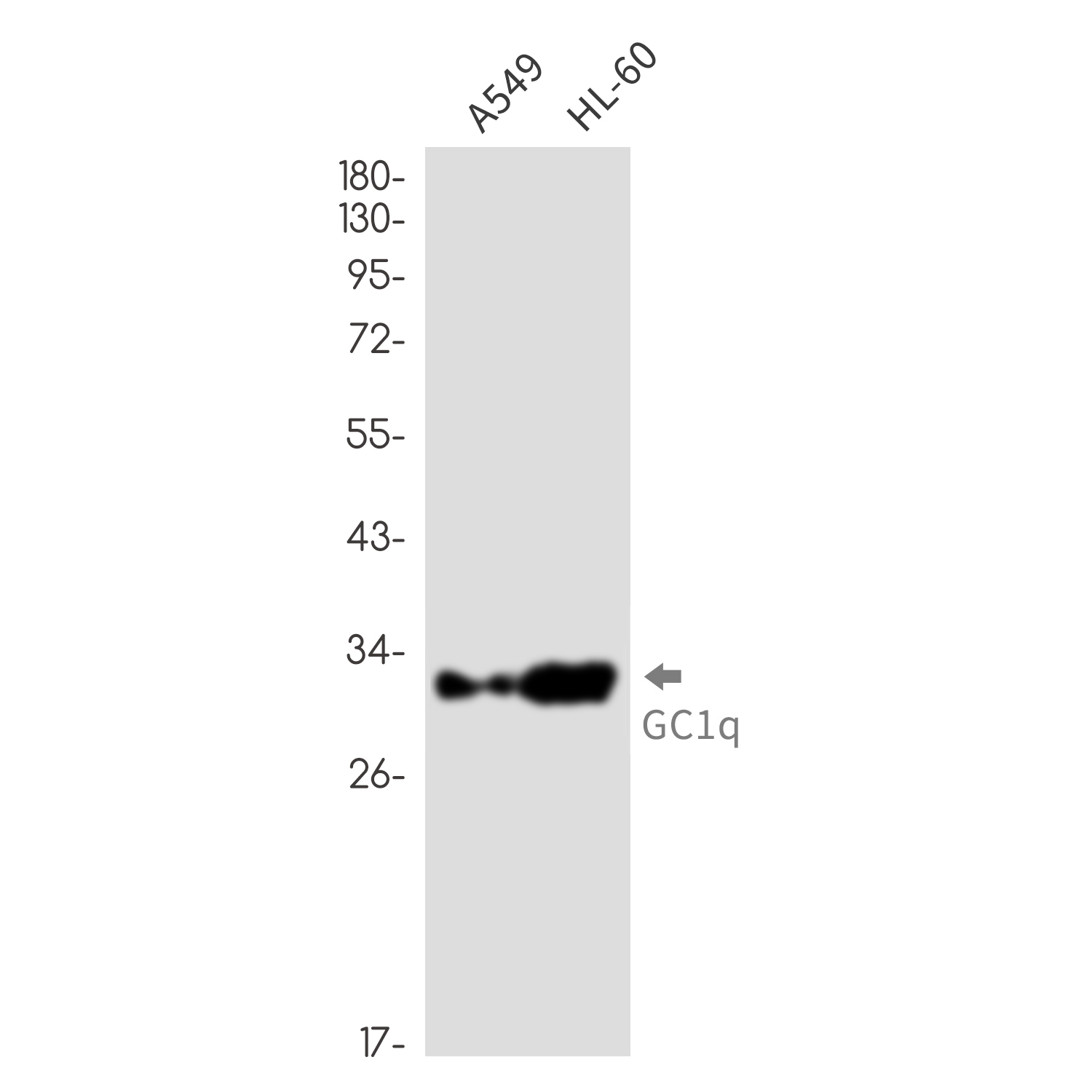 GC1q R Rabbit mAb ABZ2226